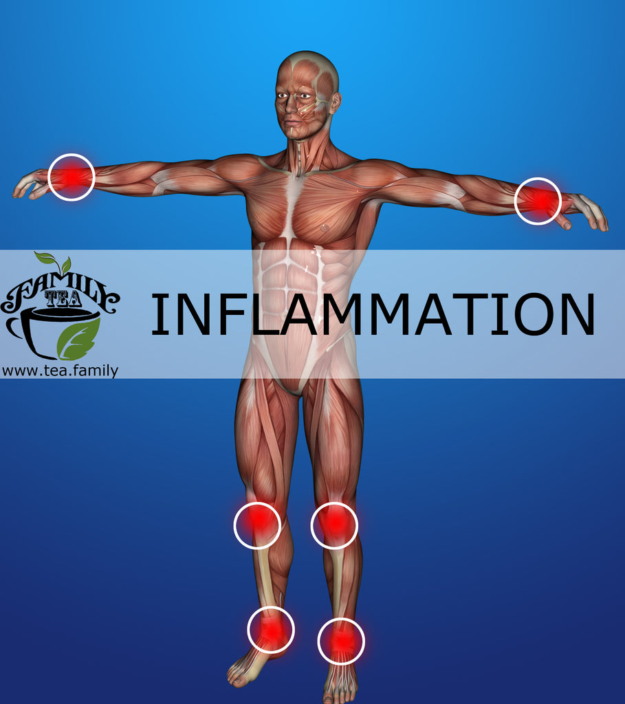 Inflammation